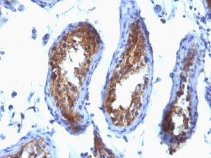Major Vault Protein IHC human Testicular Carcinoma (SPM280)